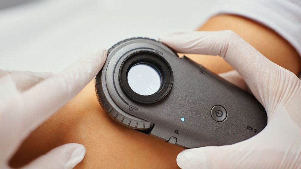 Badanie zmian skórnych dermatoskopem w DAGDERM Warszawa