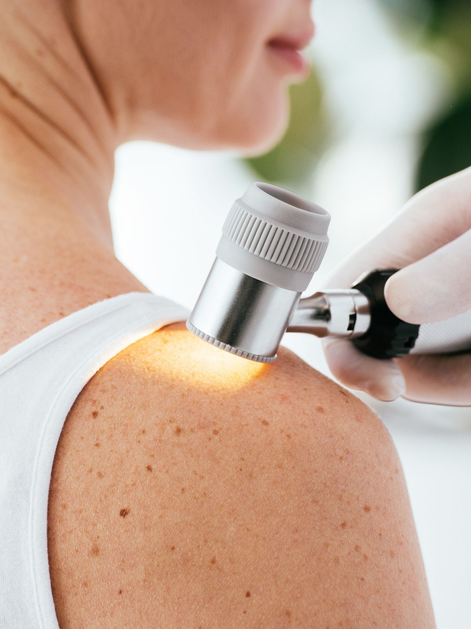 Dermatoskopia Warszawa