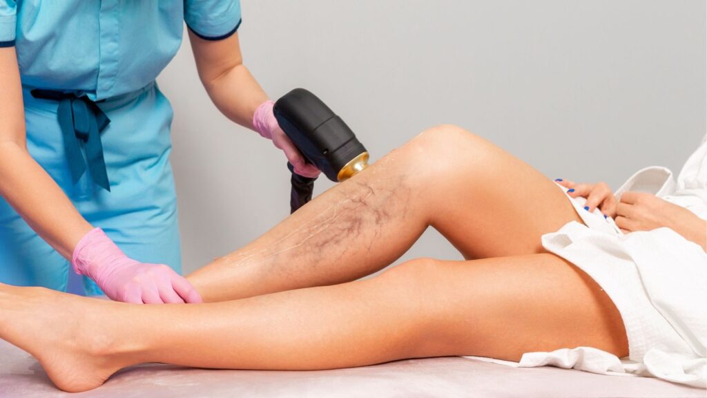 Usuwanie naczynek Warszawa dagderm