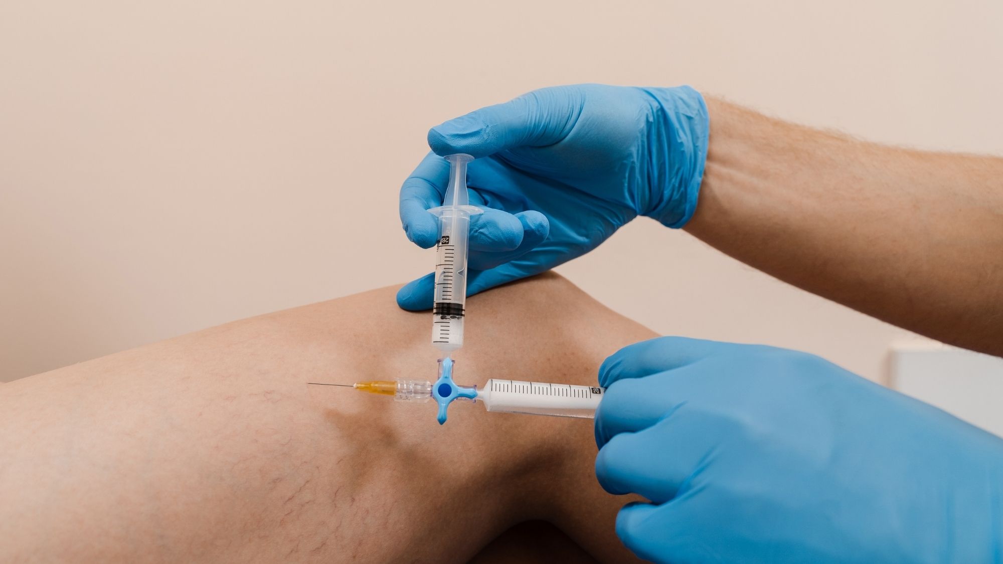 Skleroterapia warszawa u dermatologa w dagderm