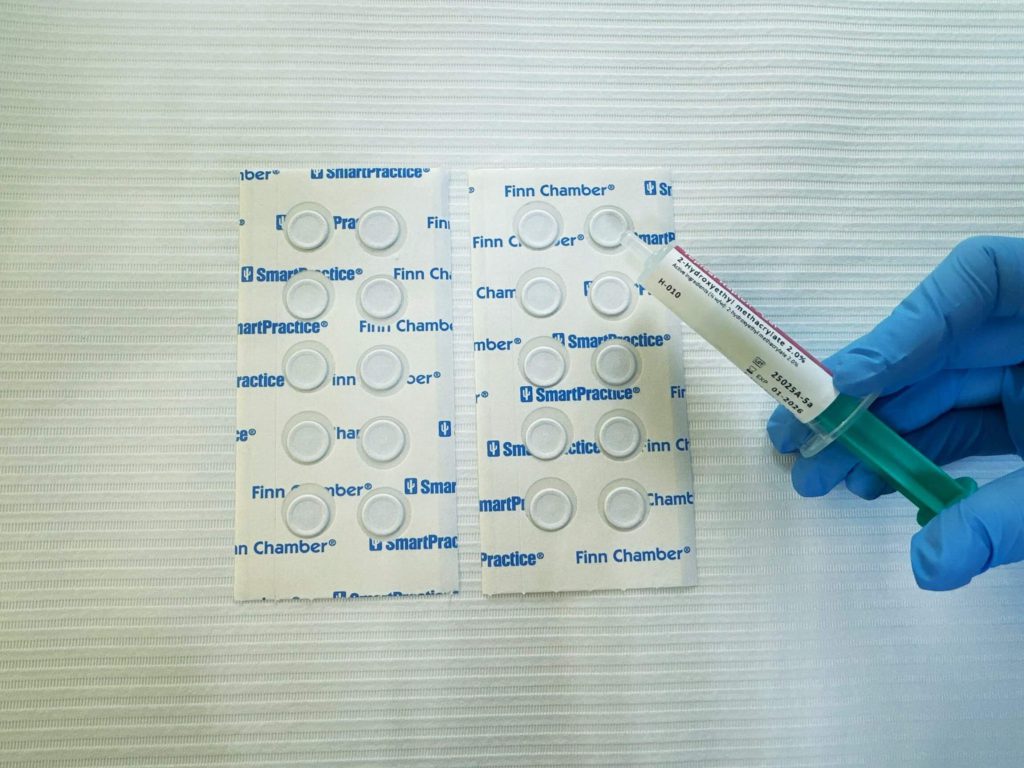 Патч-тести на контактну алергію – діагностика в DAGDERM Варшава