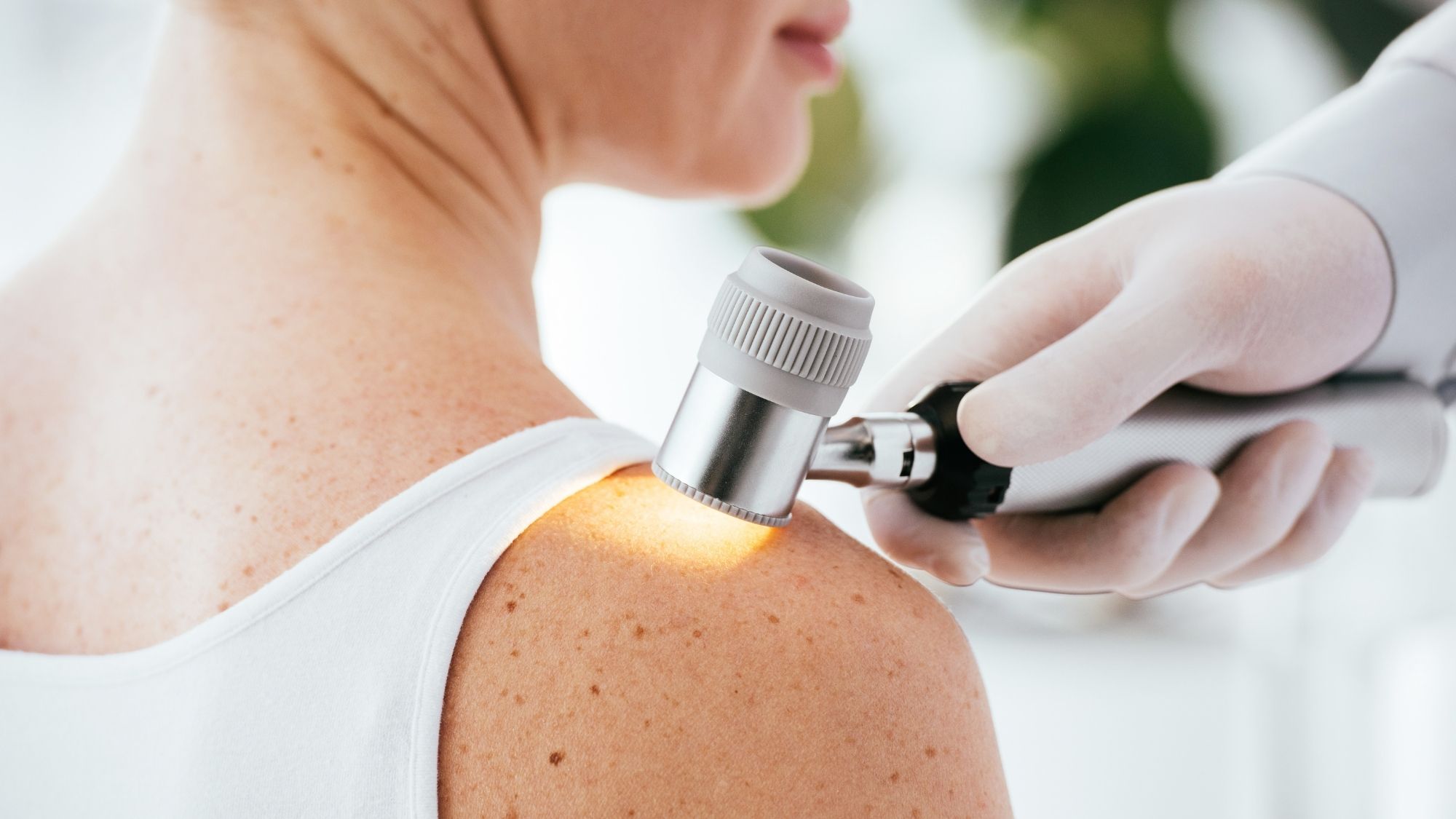 Dermatoscopy in Warszaw DAGDERM clinic