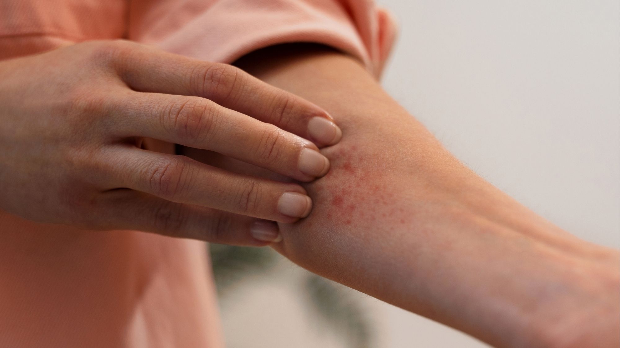 Atopowe zapalenie skóry Warszawa dermatolog