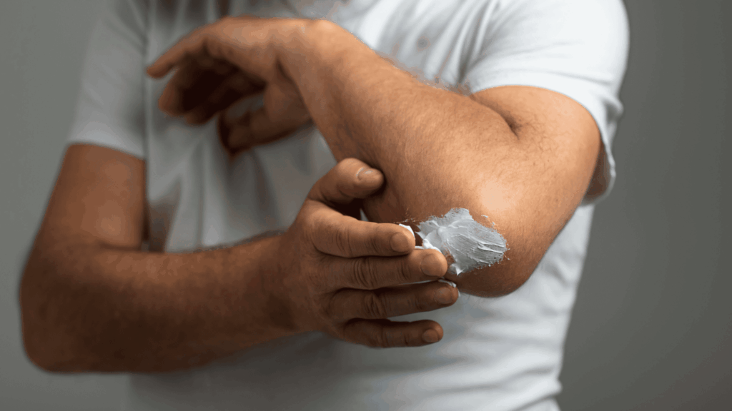 Leczenie łuszczycy Warszawa dermatolog Dagderm