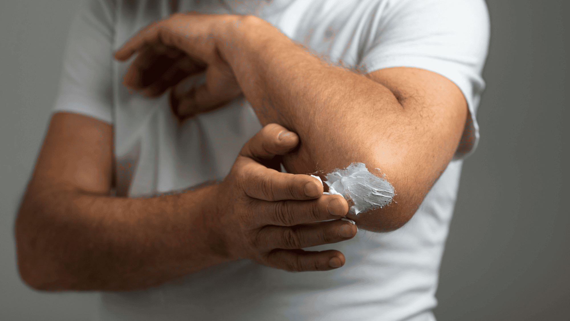 Leczenie łuszczycy Warszawa dermatolog Dagderm